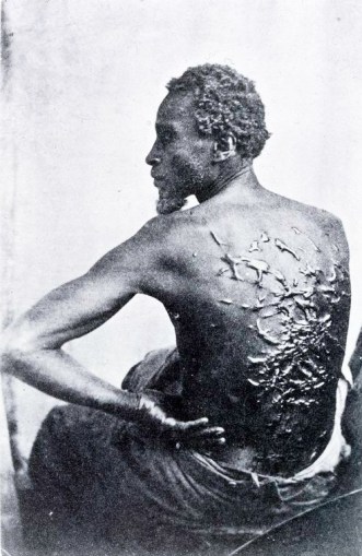 Schomberg Collection: "Wounds of Torture" 1863